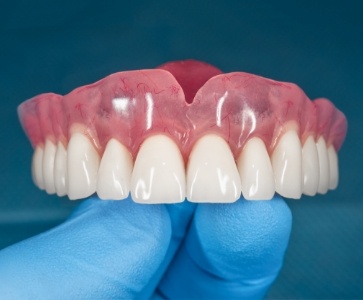 a graphic rendering depicting how dentures can be secured to dental implants