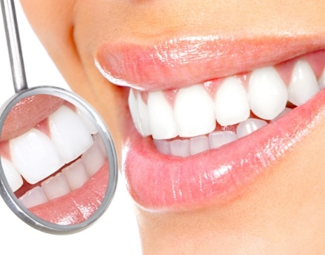 Before and after teeth whitening in Los Angeles