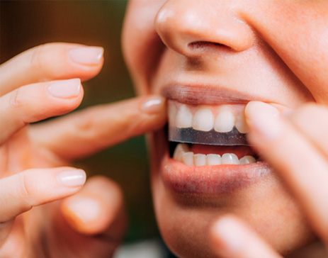 Woman applying teeth whitening strips