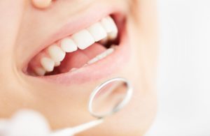 A person smiling during their dental exam.